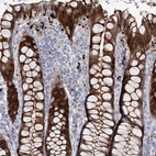 Immunohistochemical staining of human rectum shows strong cytoplasmic positivity in glandular cells.