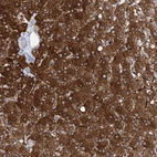 Immunohistochemical staining of human liver shows strong cytoplasmic positivity in hepatocytes.