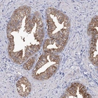 Immunohistochemical staining of human prostate shows moderate cytoplasmic and membranous positivity in glandular cells.