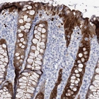 Immunohistochemical staining of human rectum shows strong cytoplasmic positivity in glandular cells.