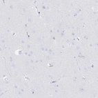 Immunohistochemical staining of human cerebral cortex shows no positivity in neurons as expected.
