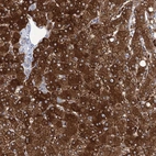 Immunohistochemical staining of human liver shows strong cytoplasmic positivity in hepatocytes.