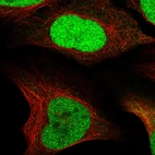 Immunofluorescent staining of human cell line U-2 OS shows localization to nucleoplasm.