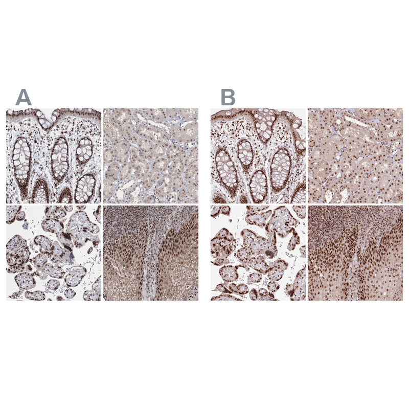 Anti-PDS5A Antibody