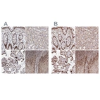 Anti-PDS5A Antibody