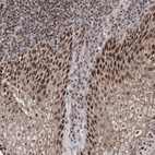 Immunohistochemical staining of human tonsil shows strong nuclear positivity in squamous epithelial cells.