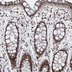Immunohistochemical staining of human rectum shows strong nuclear positivity in glandular cells.
