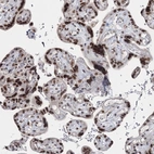 Immunohistochemical staining of human placenta shows strong nuclear positivity in trophoblastic cells.