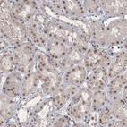 Immunohistochemical staining of human kidney shows moderate nuclear positivity in cells in tubules.