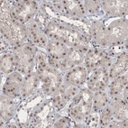 Immunohistochemical staining of human kidney shows moderate nuclear positivity in cells in tubules.