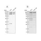Western blot analysis using Anti-PDS5A antibody HPA036661 (A) shows similar pattern to independent antibody HPA036662 (B).