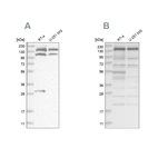 Western blot analysis using Anti-PDS5A antibody HPA036661 (A) shows similar pattern to independent antibody HPA036662 (B).