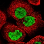 Immunofluorescent staining of human cell line A-431 shows localization to nucleoplasm.