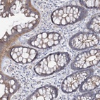 Anti-PIGC Antibody