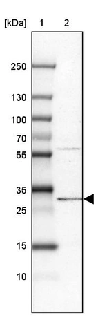 Lane 1: Marker [kDa] 250, 130, 100, 70, 55, 35, 25, 15, 10_br/_Lane 2: Human cell line SK-MEL-30