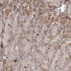 Immunohistochemical staining of human stomach shows moderate cytoplasmic/membranous positivity in glandular cells.