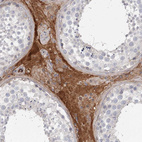 Immunohistochemical staining of human testis shows strong cytoplasmic positivity in Leydig cells.