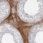 Immunohistochemical staining of human testis shows strong cytoplasmic positivity in Leydig cells.