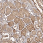 Immunohistochemical staining of human kidney shows moderate cytoplasmic positivity in cells in tubules.