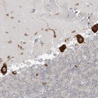 Anti-FARSB Antibody