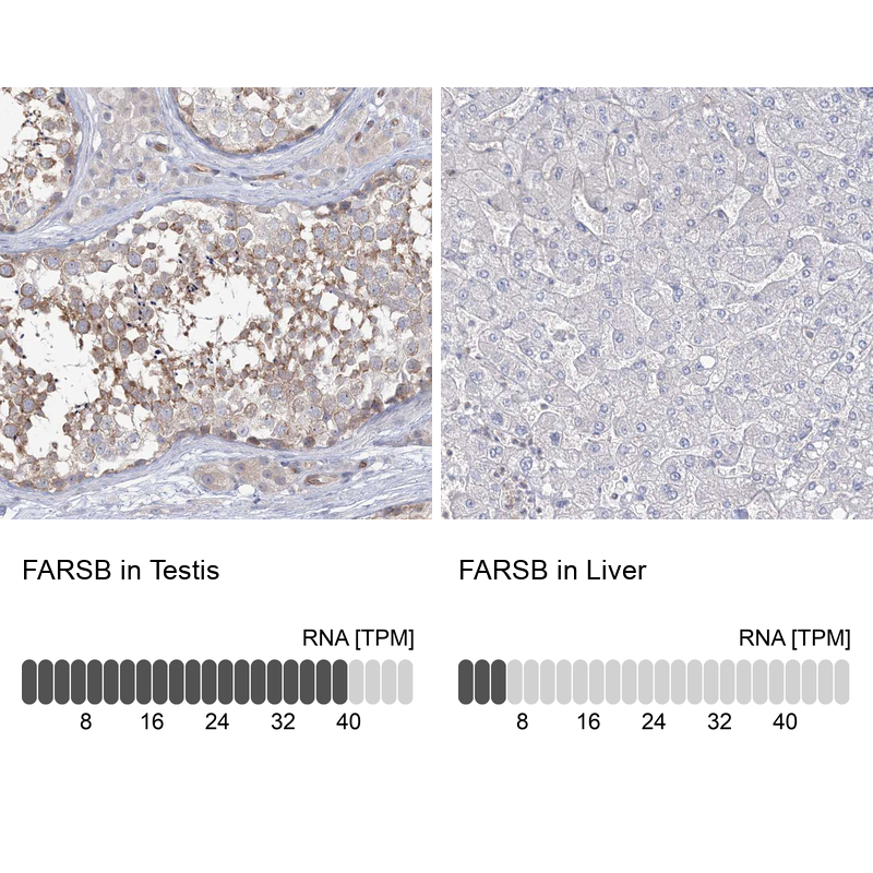 Anti-FARSB Antibody