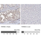 Anti-FARSB Antibody