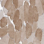 Immunohistochemical staining of human skeletal muscle shows moderate cytoplasmic positivity in myocytes.