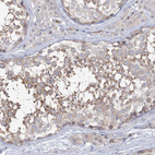 Immunohistochemical staining of human testis shows moderate cytoplasmic positivity in spermatids.