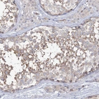 Immunohistochemical staining of human testis shows moderate cytoplasmic positivity in spermatids.