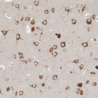 Immunohistochemical staining of human cerebral cortex shows strong cytoplasmic positivity in neuronal cells.