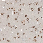 Immunohistochemical staining of human cerebral cortex shows strong cytoplasmic positivity in neuronal cells.