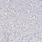 Immunohistochemical staining of human liver shows no positivity in hepatocytes as expected.