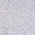 Immunohistochemical staining of human liver shows no positivity in hepatocytes as expected.