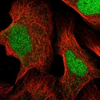 Immunofluorescent staining of human cell line U-2 OS shows localization to nucleus.
