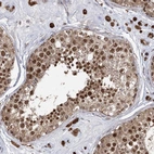 Anti-SLC4A1AP Antibody