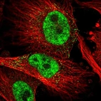 Immunofluorescent staining of human cell line U-251 MG shows localization to nucleoplasm & vesicles.