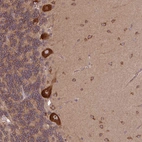Anti-PLCG1 Antibody