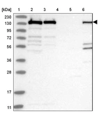 Lane 1: Marker [kDa] 230, 130, 95, 72, 56, 36, 28, 17, 11_br/_Lane 2: Human cell line RT-4_br/_Lane 3: Human cell line U-251 MG_br/_Lane 4: Human plasma_br/_Lane 5: Human Liver tissue_br/_Lane 6: Human Tonsil tissue