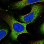 Immunofluorescent staining of human cell line U-2 OS shows localization to cytosol.