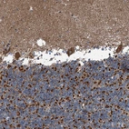 Immunohistochemical staining of human cerebellum shows strong granular cytoplasmic positivity in cells in granular layer.