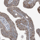 Immunohistochemical staining of human Fallopian tube shows strong granular cytoplasmic positivity in glandular cells.