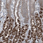 Immunohistochemical staining of human stomach shows strong granular cytoplasmic positivity in glandular cells.