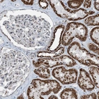 Immunohistochemical staining of human kidney shows strong granular cytoplasmic positivity in cells in tubules.