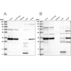 Western blot analysis using Anti-SUCLG1 antibody HPA036684 (A) shows similar pattern to independent antibody HPA036683 (B).