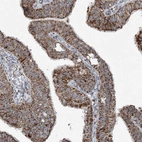 Immunohistochemical staining of human Fallopian tube shows strong granular cytoplasmic positivity in glandular cells.
