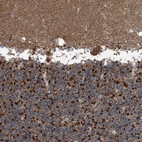 Immunohistochemical staining of human cerebellum shows strong granular cytoplasmic positivity in cells in granular layer.