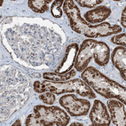Immunohistochemical staining of human kidney shows strong granular cytoplasmic positivity in cells in tubules.