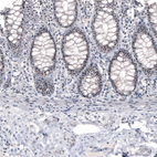 Immunohistochemical staining of human colon strong nucleolar positivity in glandular cells.
