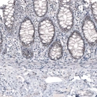 Immunohistochemical staining of human colon strong nucleolar positivity in glandular cells.