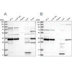 Western blot analysis using Anti-SUCLG1 antibody HPA036683 (A) shows similar pattern to independent antibody HPA036684 (B).